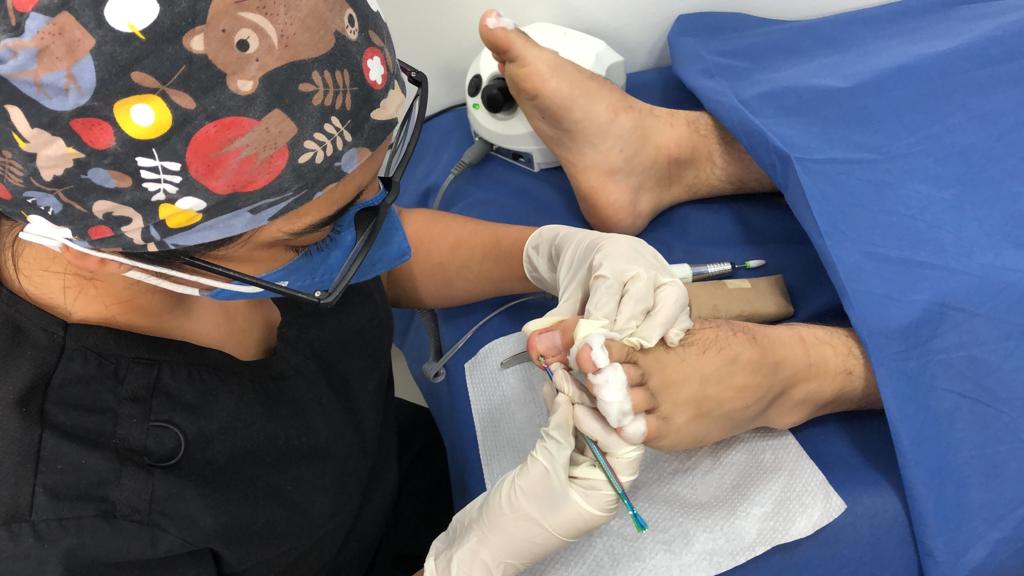 thumbnail_Tratamiento podología